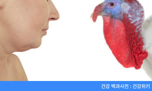 거북목 얼굴 변화