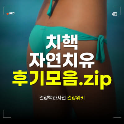 치핵 자연치유 후기