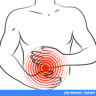 위염에 안좋은 음식